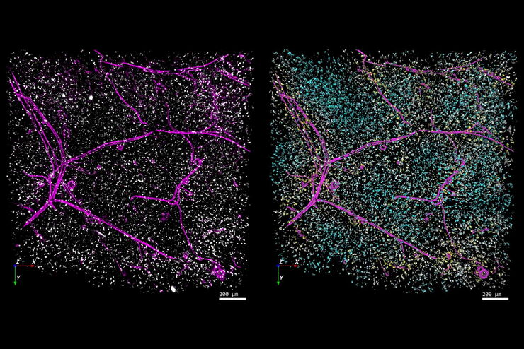 Blood vessels imaged with THUNDER & Aivia Left-hand image: The distribution of immune cells (white) and blood vessels (pink) in white adipose tissue (image captured using the THUNDER Imager 3D Cell Culture). Right-hand image: The same image after automated analysis using Aivia, with each immune cell color-coded based on its distance to the nearest blood vessel. Image courtesy of Dr. Selina Keppler, Munich, Germany.