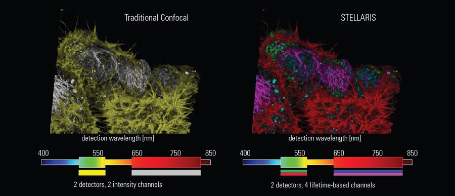 Fluorescence lifetime-based multicolor imaging in live NE-115 cells. Actin: LifeAct-mNeonGreen (left: yellow, right: red); mitochondria: MitoTracker Green (left: yellow, right: green); nuclei: NUC Red (left: gray, right: blue); and tubulin: SiR-tubulin (left: gray, right: magenta). Imaging performed with TauSeparation.