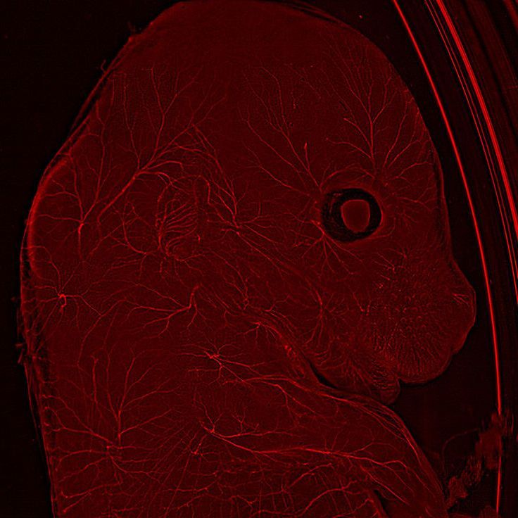 Neurofilaments stained in red to assess neuronal outgrowth in an E12-14 mouse. The mouse was uncleared. Courtesy of Y. Lutz, Centre d’imagerie, IGBMC, France.