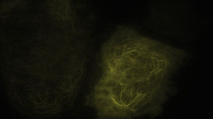 TIRF Image of Tubulin, YFP, penetration depth: 120 mm TIRF Image of Tubulin, YFP, penetration depth: 120 mm
