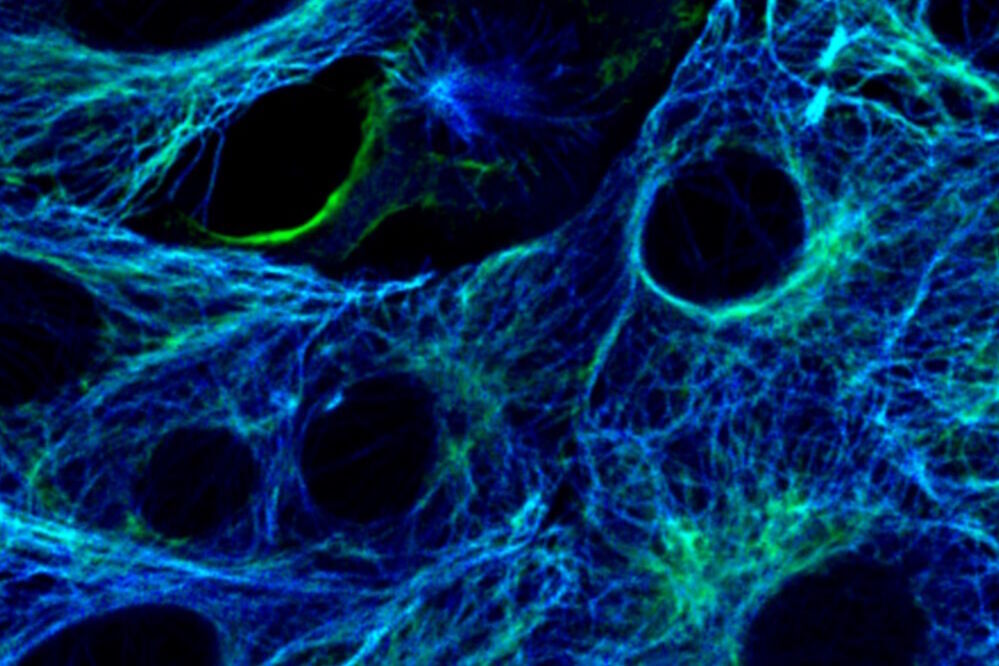 Vimentin immunolabeled with Alexa Fluor 555 (green), and tubulin immunolabeled with Alexa Fluor 546 (blue). The fluorophores are spectrally very similar, but they are separated using the fluorescence lifetime information.