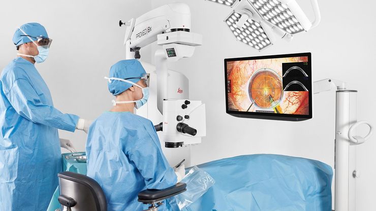 Comfortable heads-up 3D ophthalmic surgery using the Proveo 8x microscope, with a surgeon and assistant viewing a 32" monitor through 3D glasses.