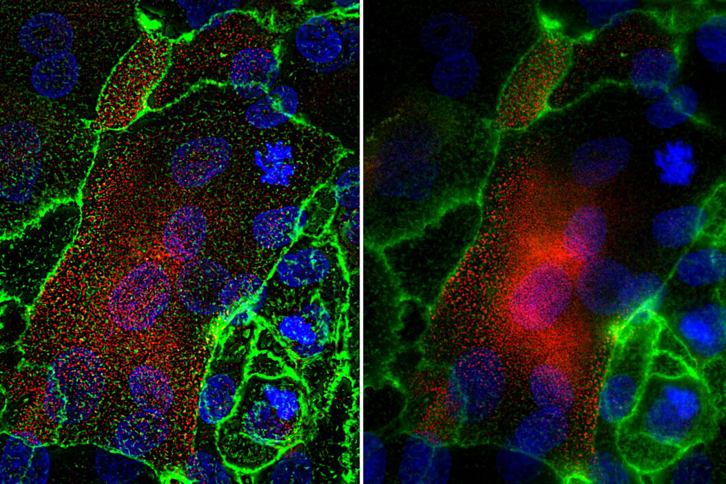  Role_of_Mucins_and_Glycosylation_in_Dry_Eye_Disease_teaser.jpg