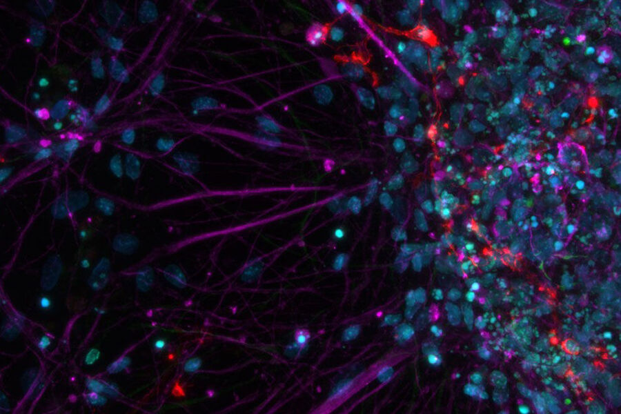 Primary cell culture from rat; Cy5 (magenta): Beta-III tubulin; Rhod (red): NG2 protein, GFP (green): Nestin protein; and DAPI (blue): nuclei.