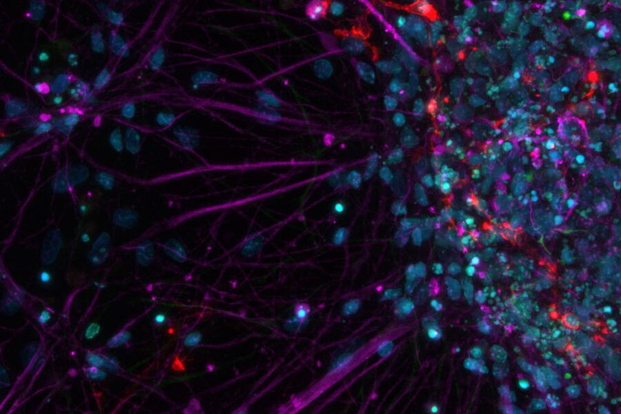 Primary cell culture from rat; Cy5 (magenta): Beta-III tubulin; Rhod (red): NG2 protein, GFP (green): Nestin protein; and DAPI (blue): nuclei.