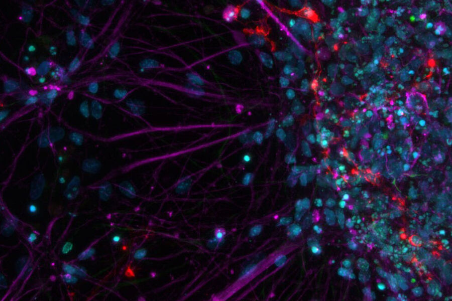 Primary cell culture from rat; Cy5 (magenta): Beta-III tubulin; Rhod (red): NG2 protein, GFP (green): Nestin protein; and DAPI (blue): nuclei.