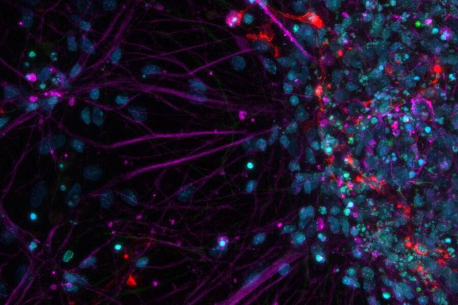 Primary cell culture from rat; Cy5 (magenta): Beta-III tubulin; Rhod (red): NG2 protein, GFP (green): Nestin protein; and DAPI (blue): nuclei.