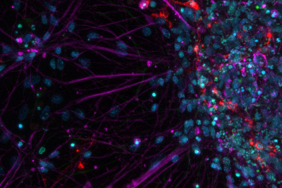 Primary cell culture from rat; Cy5 (magenta): Beta-III tubulin; Rhod (red): NG2 protein, GFP (green): Nestin protein; and DAPI (blue): nuclei.