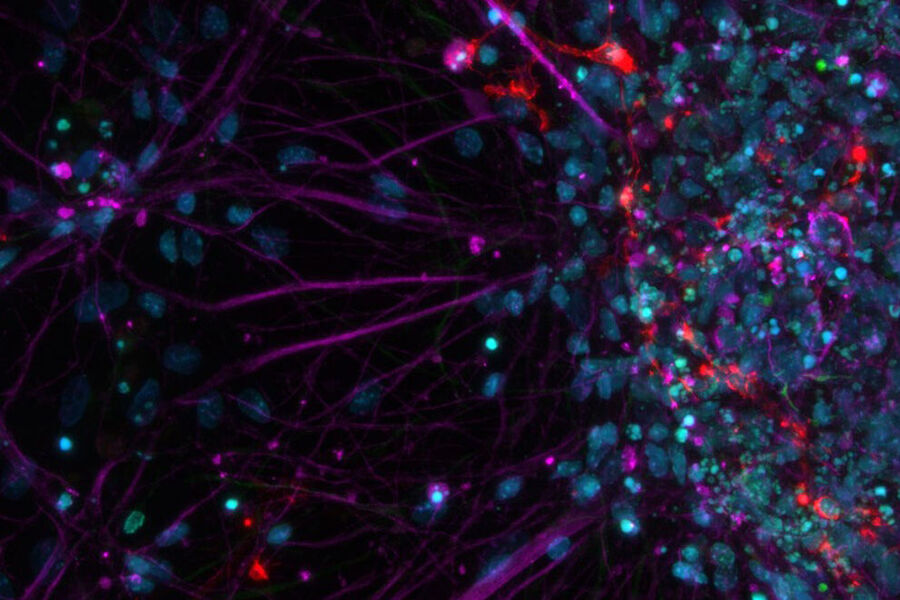 Primary cell culture from rat; Cy5 (magenta): Beta-III tubulin; Rhod (red): NG2 protein, GFP (green): Nestin protein; and DAPI (blue): nuclei.