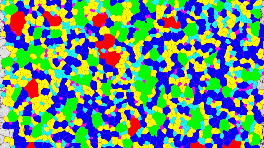 Digital all grains Inverted Microscope