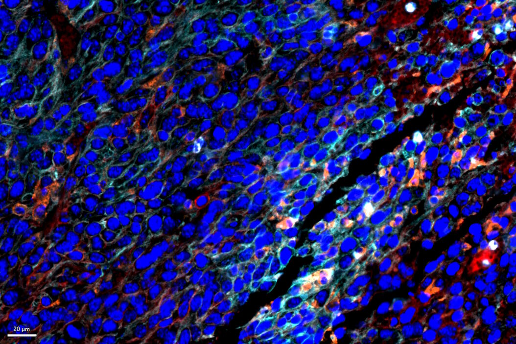 Clustering based analysis reveals various immune cell populations enriched in tumor cells within CT26.WT syngeneic mouse tumor models.  Immune_cells_in_tumor_cells_within_CT26WT_syngeneic_mouse_tumor_models.jpg