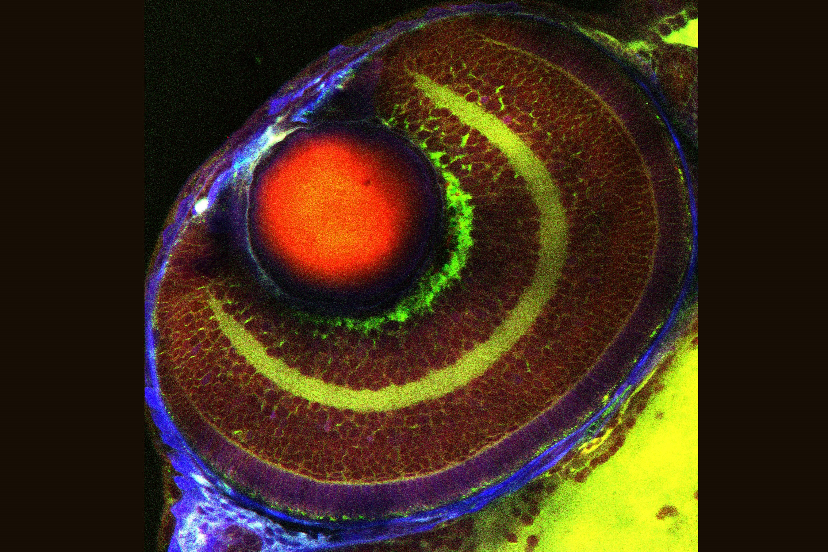 Obtención de imágenes sin marcadores con el microscopio confocal Leica TCS SP8 CARS