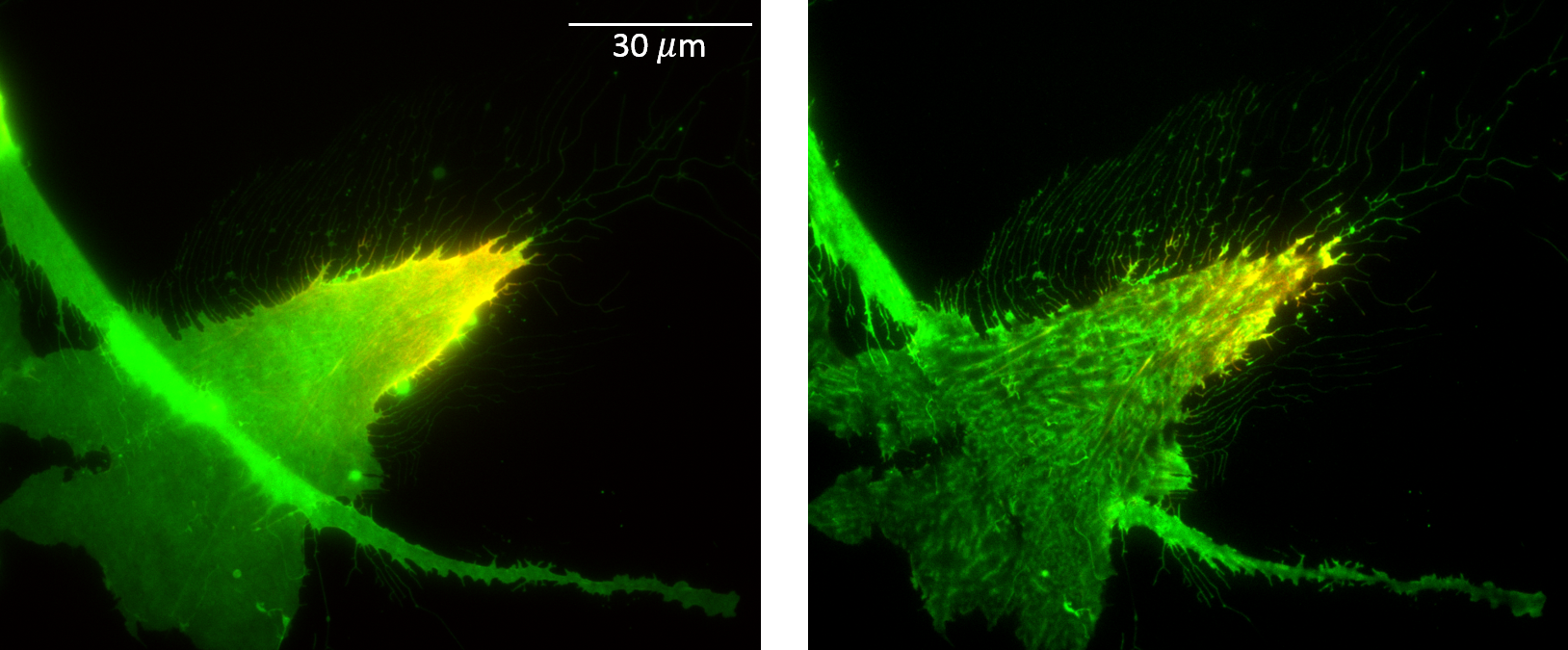 Randomly polarized RPE-1 (retinal pigmented epithelial) cell migrating on fibronectin. 