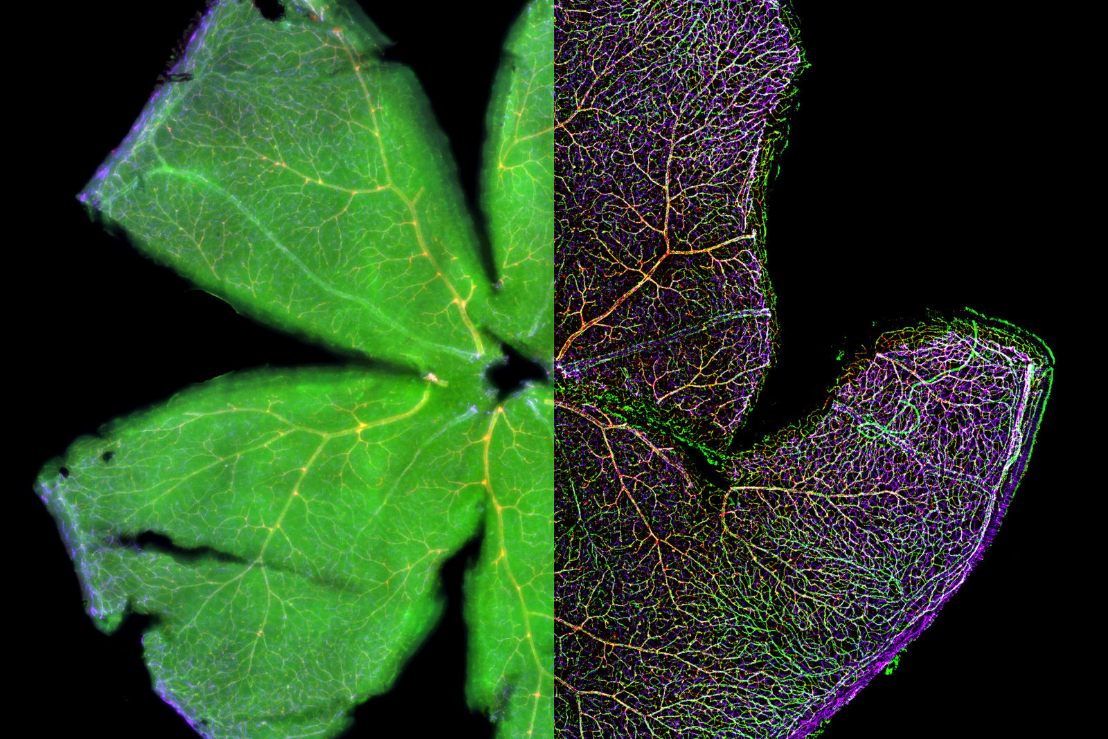 Mouse retina Mouse retina was fixed and stained by following reagents: anti-CD31 antibody (green): Endothelia cells, IsoB4 (red): Blood vessels, and microglia anti-GFAP antibody (blue): Astrocytes Sample courtesy by Jeremy Burton, PhD and Jiyeon Lee, PhD, Genentech Inc., South San Francisco, USA. Imaged by Olga Davydenko, PhD (Leica).