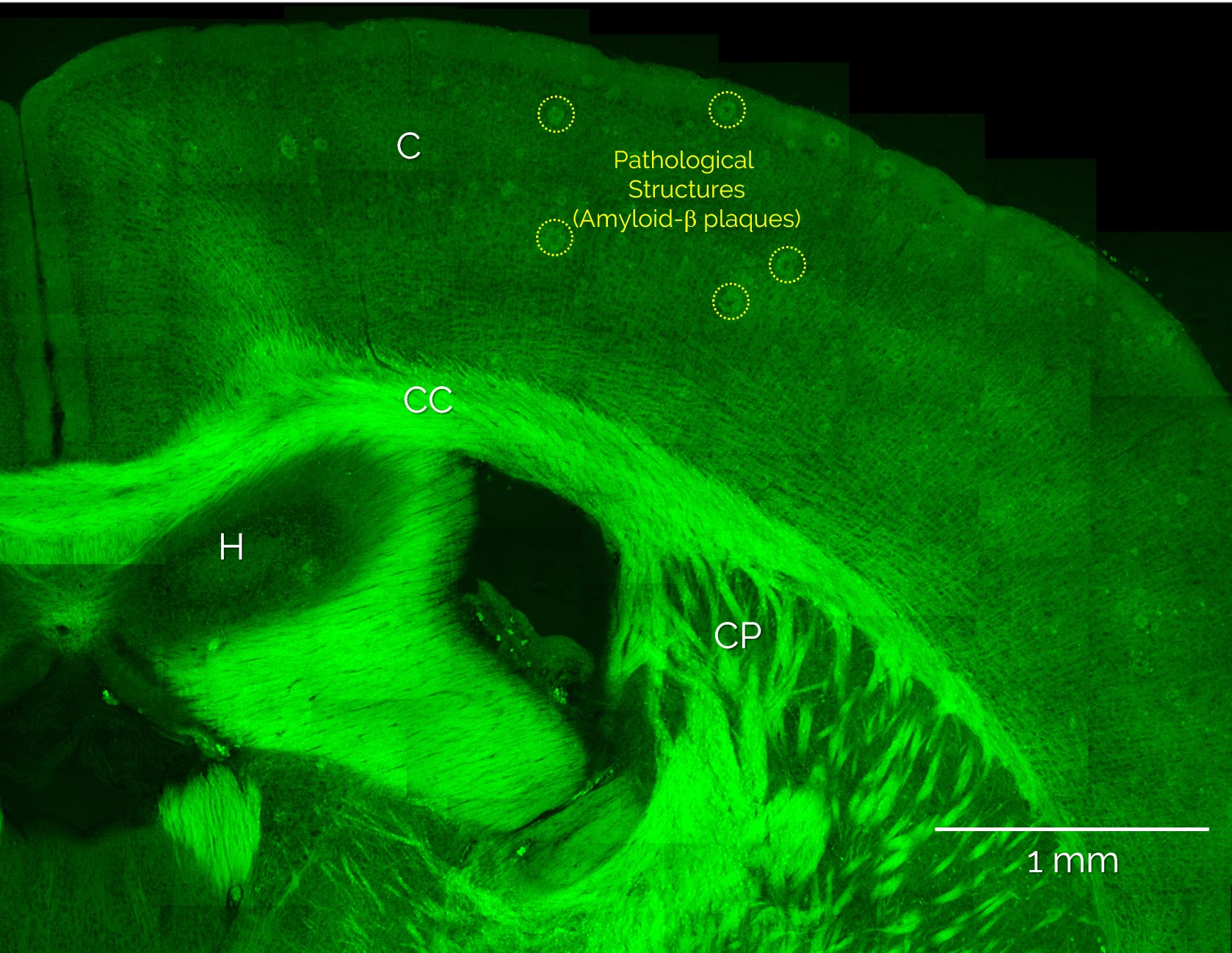 Figure 1: Label-free, large-scale overview image of an unlabeled, diseased mouse brain slice