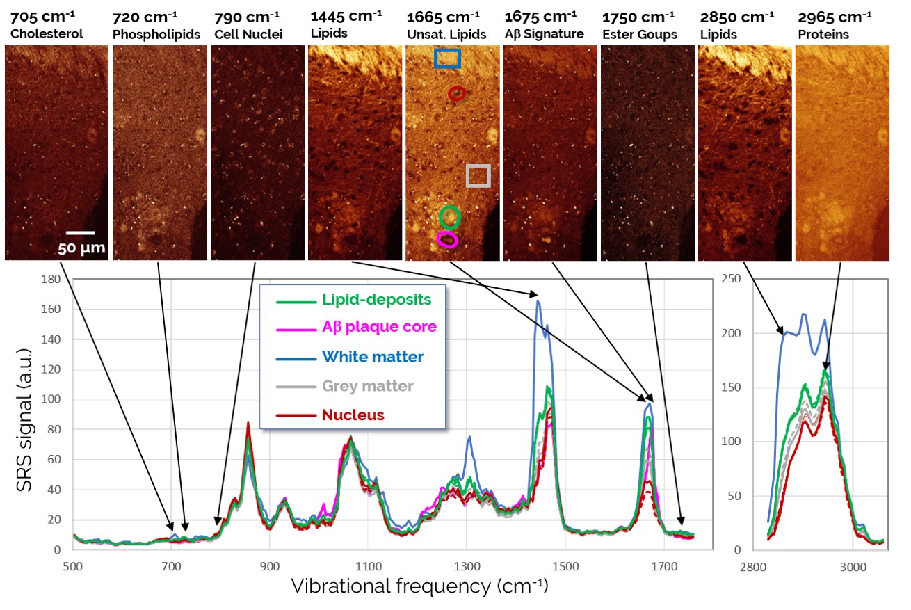 SRS spectroscopic imaging of brain tissues.