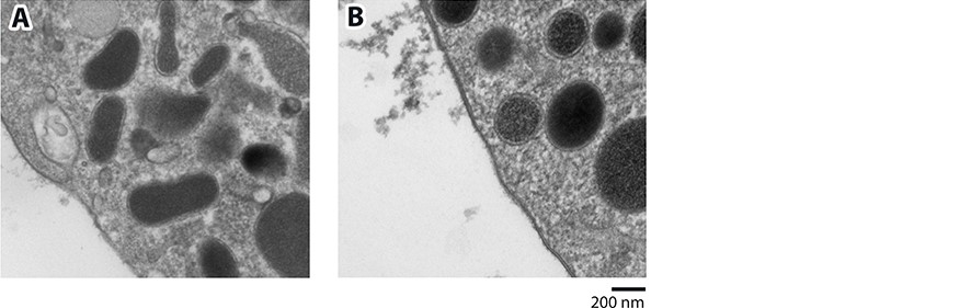 Chemical-fixation versus cryo-fixation