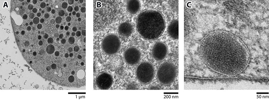 Representative micrographs showing a primary bovine chromaffin cell (A), large dense core vesicles with preserved cores (B), and a large dense core vesicle docked at the plasma membrane with a clearly visible lipid bilayer (C).
