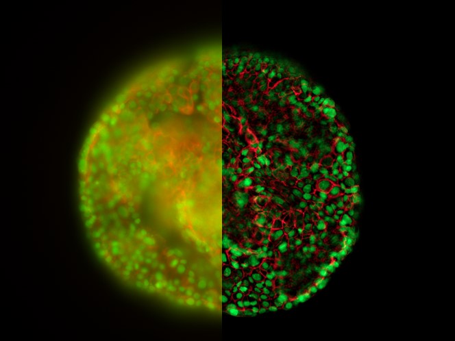 THUNDER technology applied at room temperature on a HeLa cell spheroid