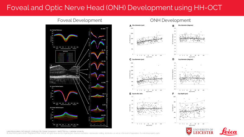 Assessment of Foveal and Optic Nerve Head Development