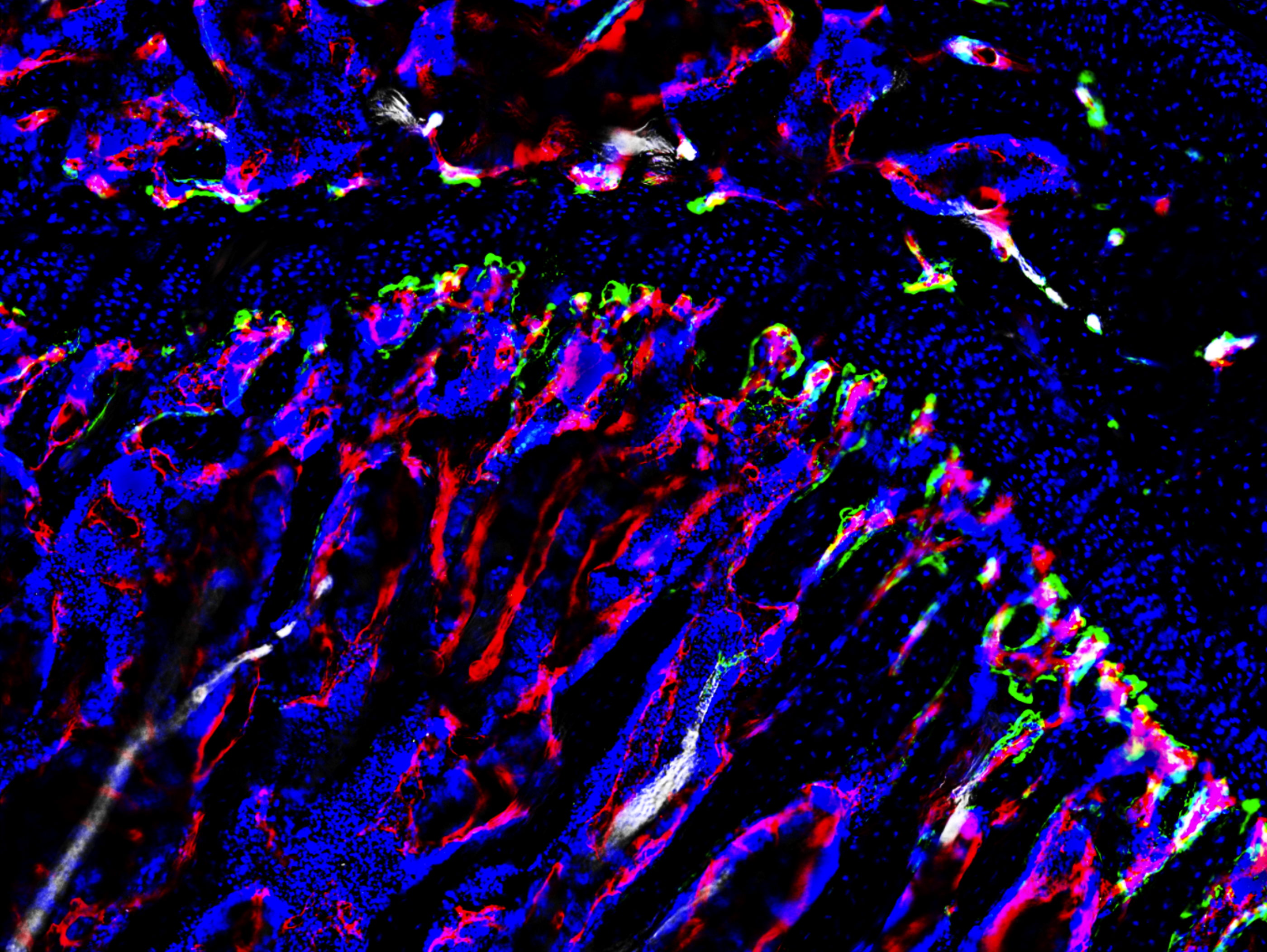 Fluorescently stained mouse tibia, imaged with a THUNDER Imager 3D Tissue. Courtesy of Dr. Anjali Kusumbe, University of Oxford, UK.