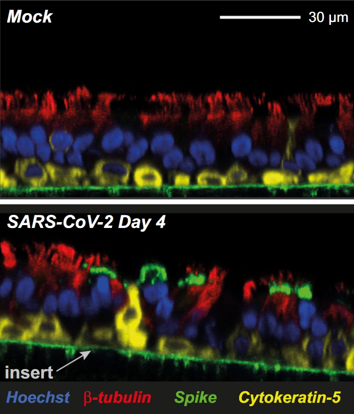 Confocal imaging of control (Mock) and of a SARS-CoV-2-infected epithelia at 4 dpi