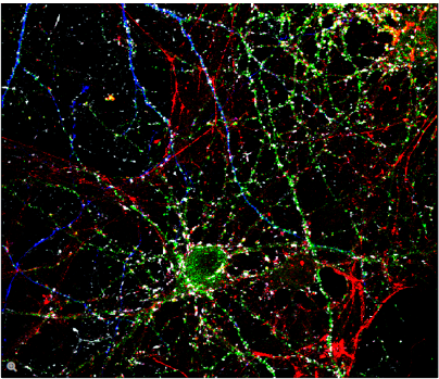 图4：小鼠原代海马神经元细胞，蓝色：转染细胞标记；绿色：肌动蛋白，TRITC；红色：GluA Ampa受体单位，Texas Red；灰色：突触小泡蛋白，Cy 5