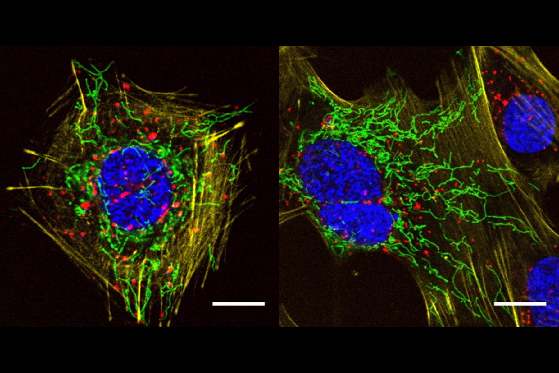 Live cells incubated with R110-SNMe2 (green), TMR-actin (yellow), SiRr-lysosome (red), and Hoechst (blue), imaged directly without any washing steps. Scale bar: 10 μm. Images courtesy: Lu Wang, Kai Johnsson, MPI-MF, Heidelberg.