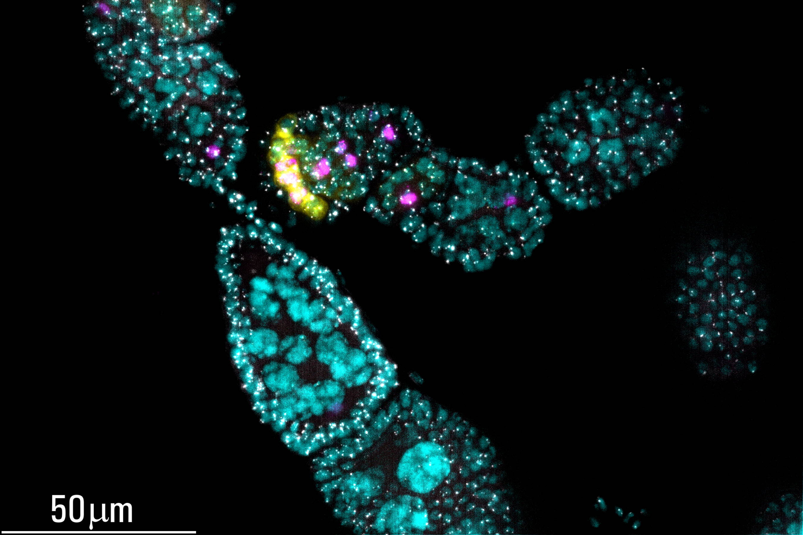 THUNDER image of early prophase Drosophila germarium.