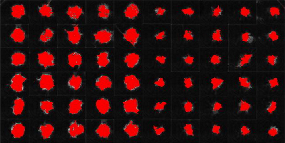MDCK cells stably transfected with MX1-GFP with trained pixel classifier MDCK cells stably transfected with MX1-GFP with trained pixel classifier