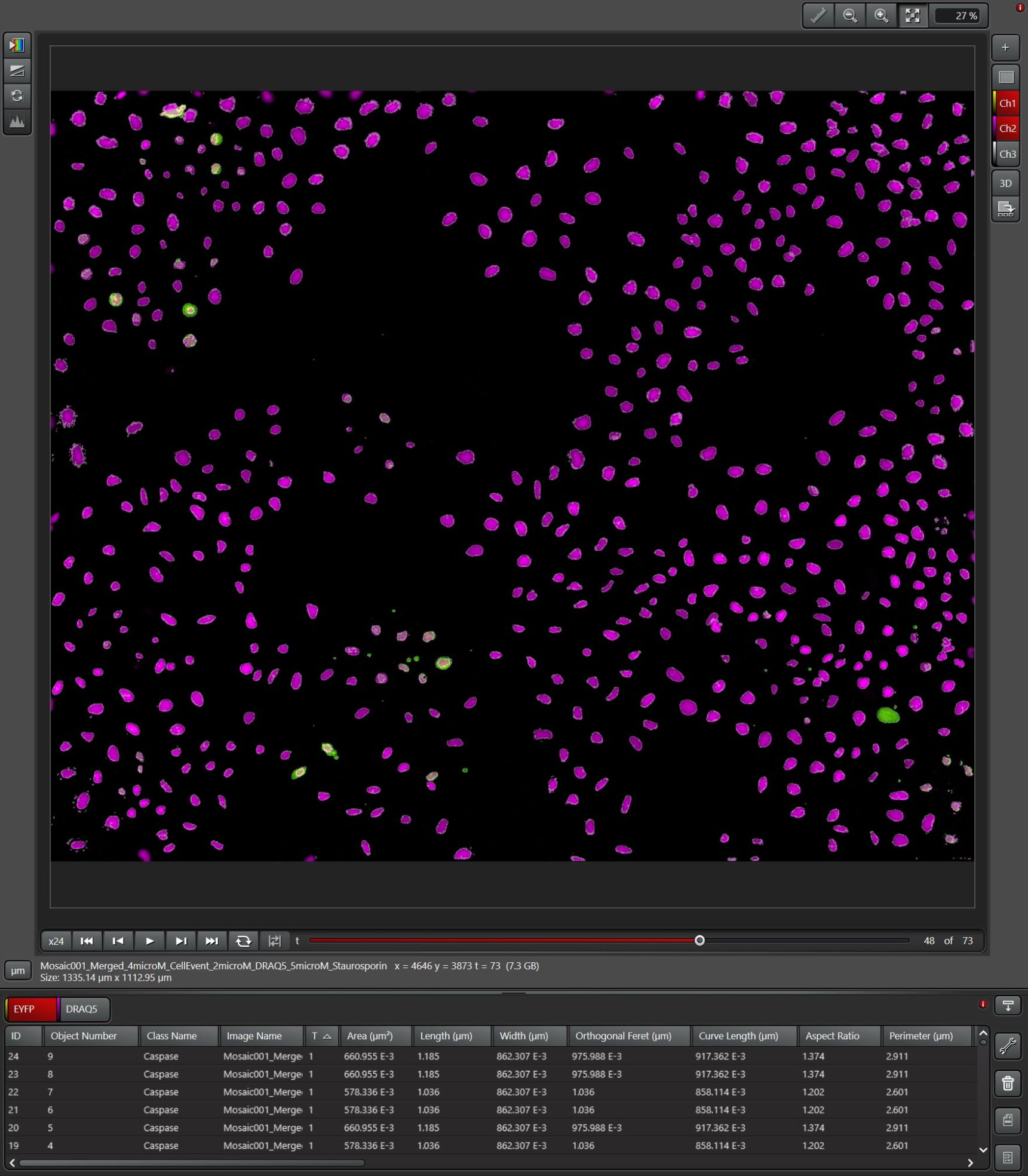 Apoptosis DRAQ5; Caspase Count; Pixel Classifier Apoptosis DRAQ5; Caspase Count; Pixel Classifier