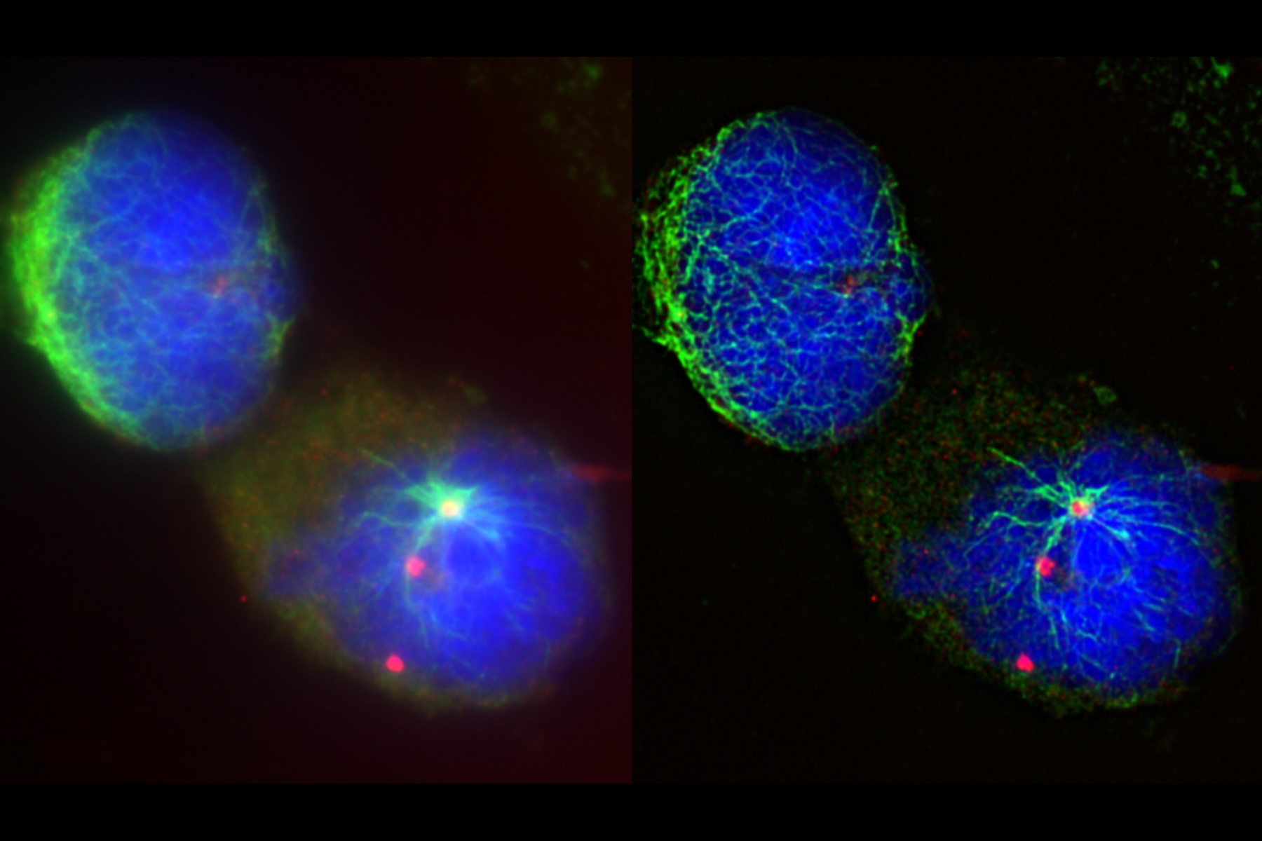 Raw widefield (left) and THUNDER (right) image of Ewing Sarcoma cells (SK-ES-1) Raw widefield (left) and THUNDER (right) image of Ewing Sarcoma cells (SK-ES-1).