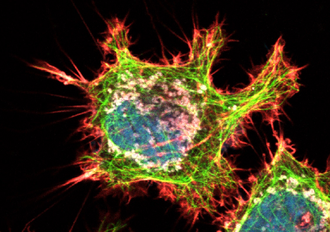 HeLa cells (fi broblasts) with crosstalk; blue: Dapi, nucleus; green: Alexa 488, tubulin; red: TRITC phalloidin, actin; grey: Mito Tracker Red CMXRos, mitochondria.