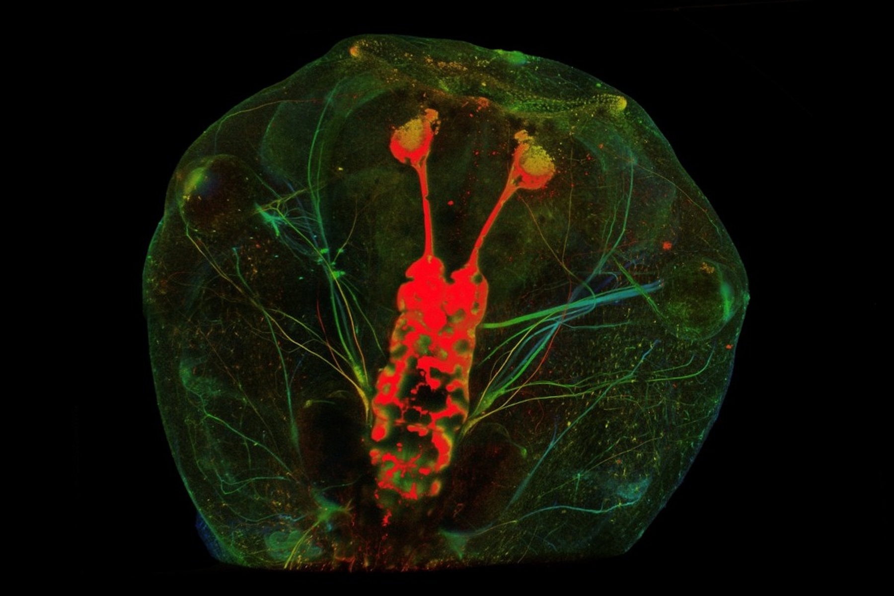 Optic nerve regeneration in the Xenopus laevis tadpole.