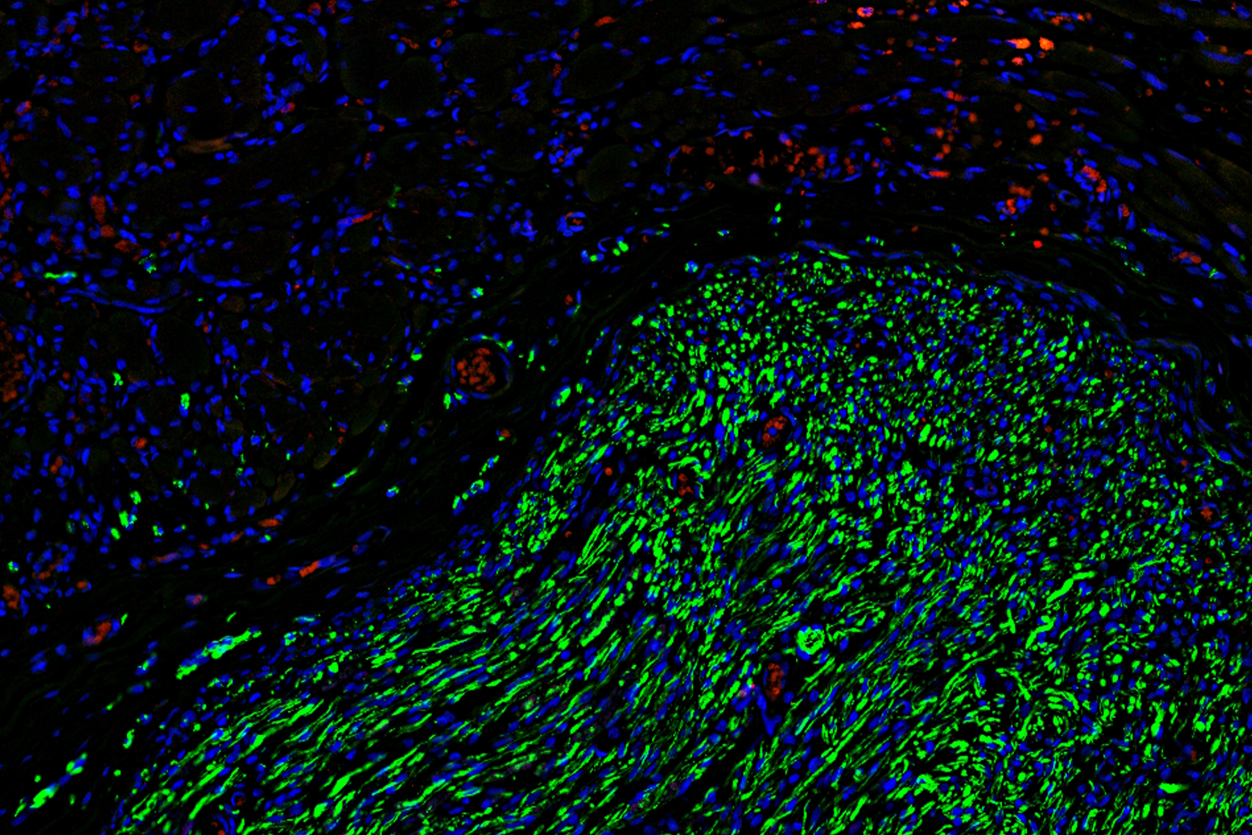 Fluorescence microscopy of sectioned tissue, showing the interface between the extensor digitorum longus muscle and the common peroneal nerve in the adult rat. Regenerative peripheral nerve interface (RPNI) at 2 weeks. Image acquired using Mica. Stained for nuclei (blue), neurofilaments (green) and S100B (red). Image courtesy of Dr. Aaron Lee, Department of Bioengineering (Lab of Dr. Rylie Green), Imperial College London.