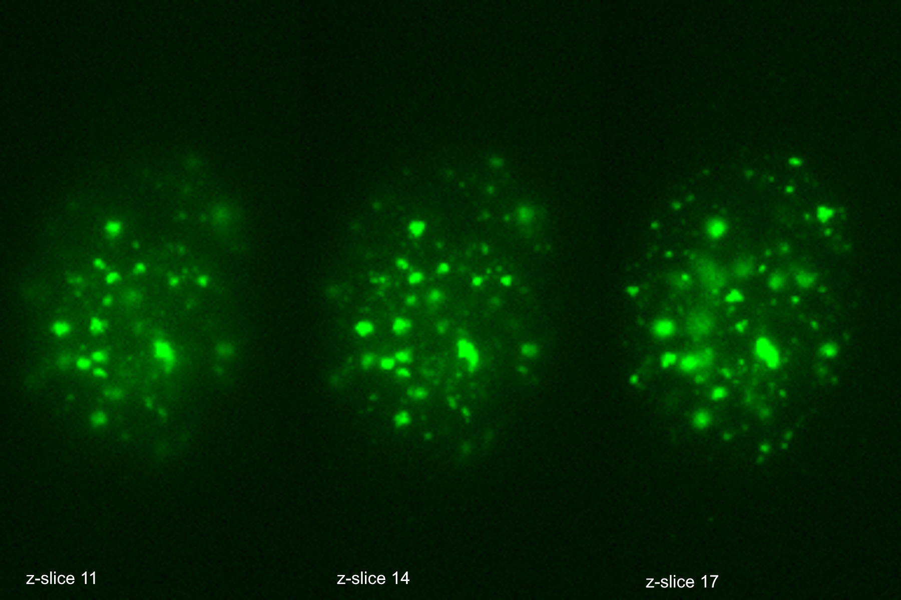 These images illustrate the need for multiple z-slices to capture all gH2Ax foci in a given cell and get an accurate count. 