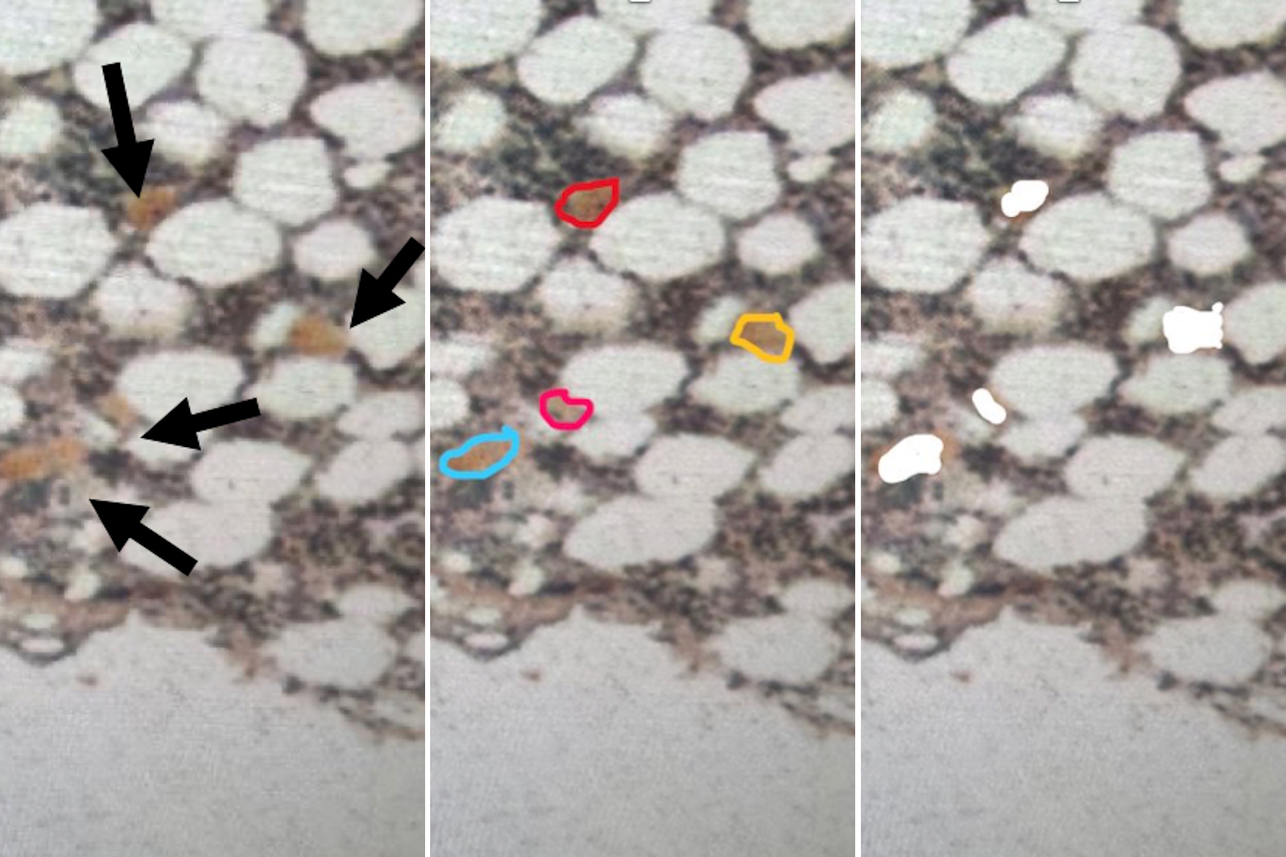 Low-input spatial proteomics workflow for megakaryocyte isolation from bone marrow.