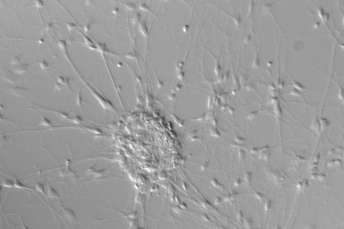 Neurons imaged in DIC.