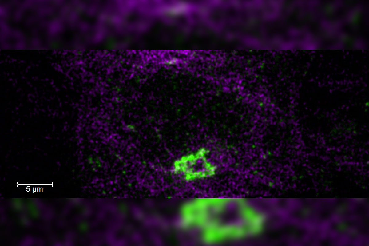 HeLa Kyoto cells. Courtesy of Dr. Juan Jung, EMBL, Heidelberg, Germany.