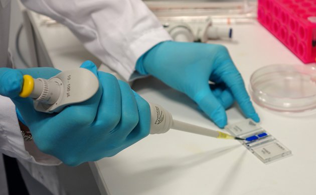 Load the counting chamber with the cell suspension (~ 4 µl per counting area) by placing the pipette tip at the edge of the cover slip and gently expel the cell suspension