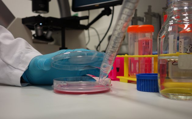 Pipette the required volume of cells (appropriate number of cells) into new dishes at the required split ratio