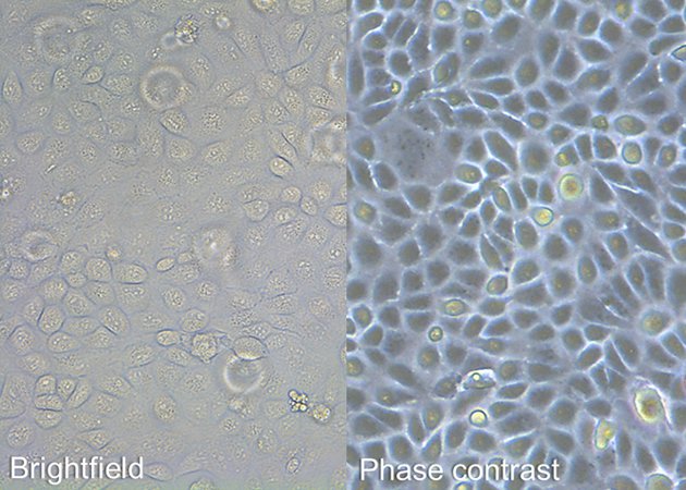 Comparison of brightfield and phase contrast images of MDCK cells.