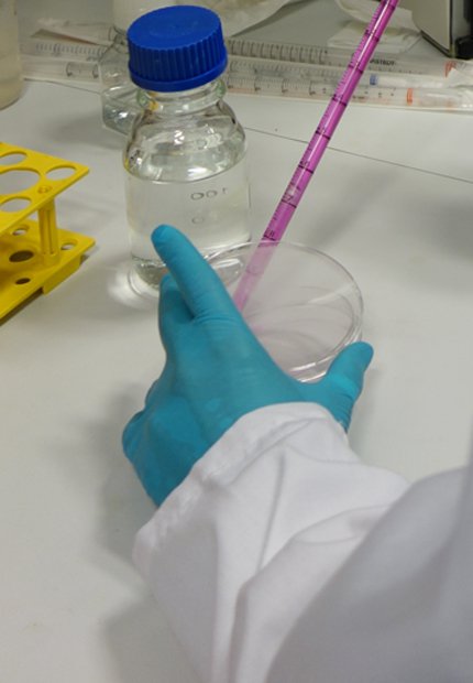 Pipet off the medium from cells into a waste container.