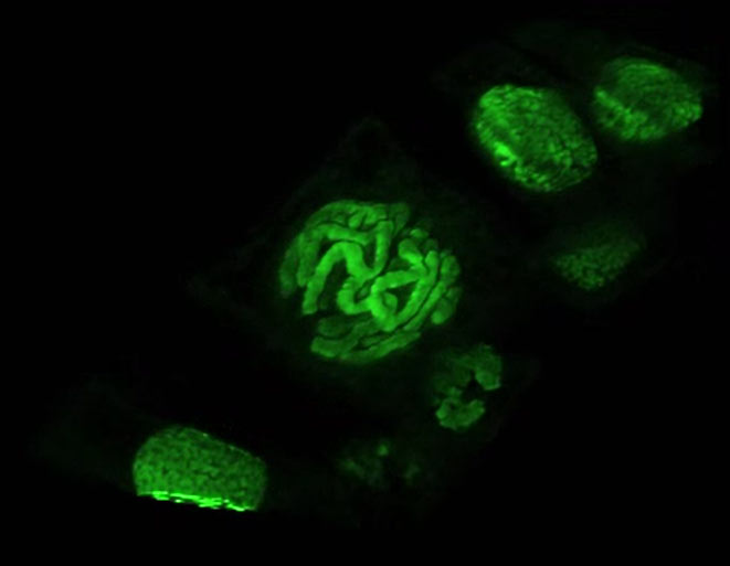 Chromosomes, after Chromosomes, after