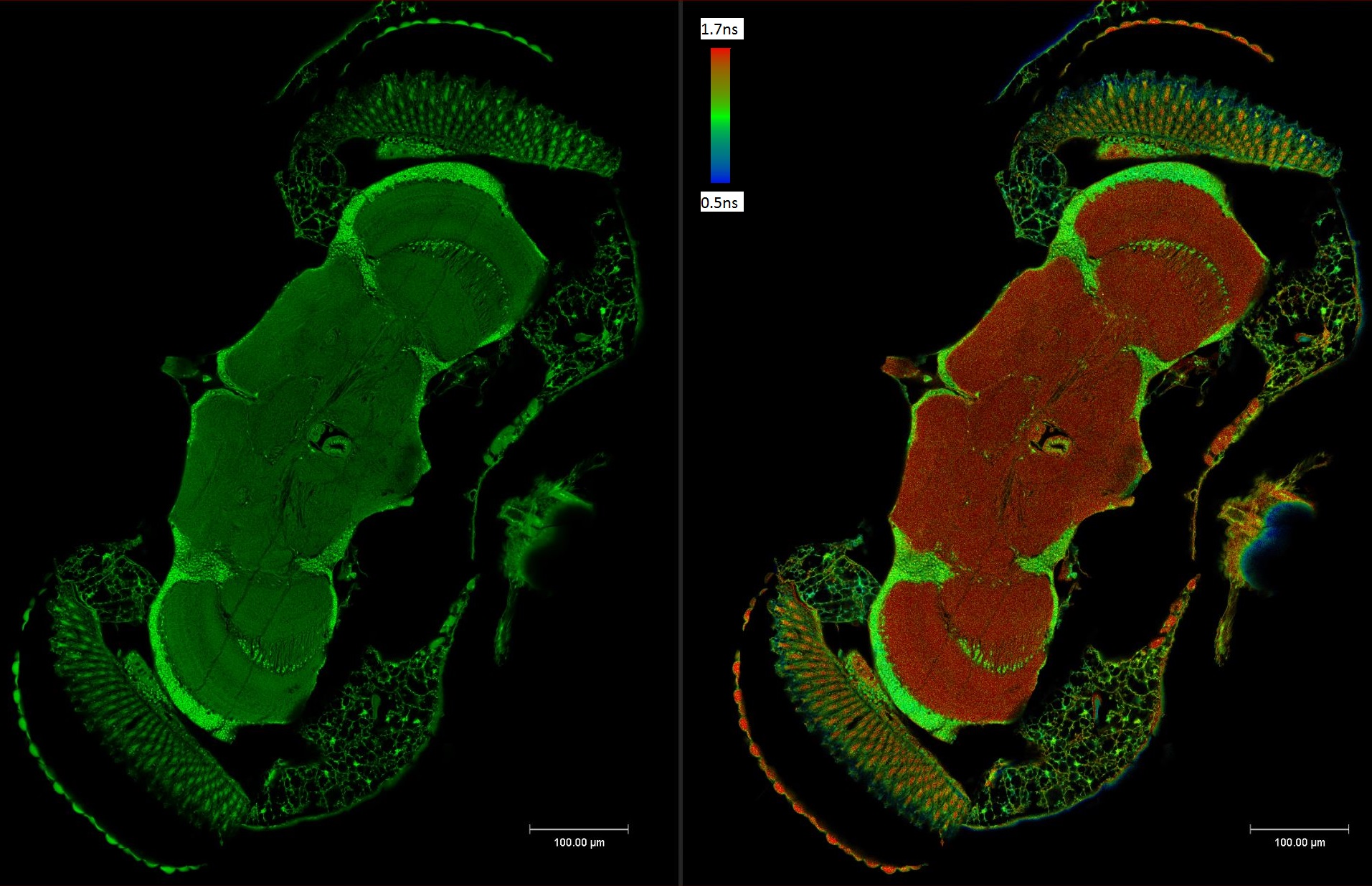 Detail view from a tile scan of an unstained paraffin section of an adult Drosophila brain Detail view from a tile scan of an unstained paraffin section of an adult Drosophila brain