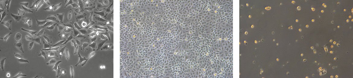 Células semelhantes a fibroblastos, células epiteliais e células semelhantes a linfoblastos (da esquerda para a direita).