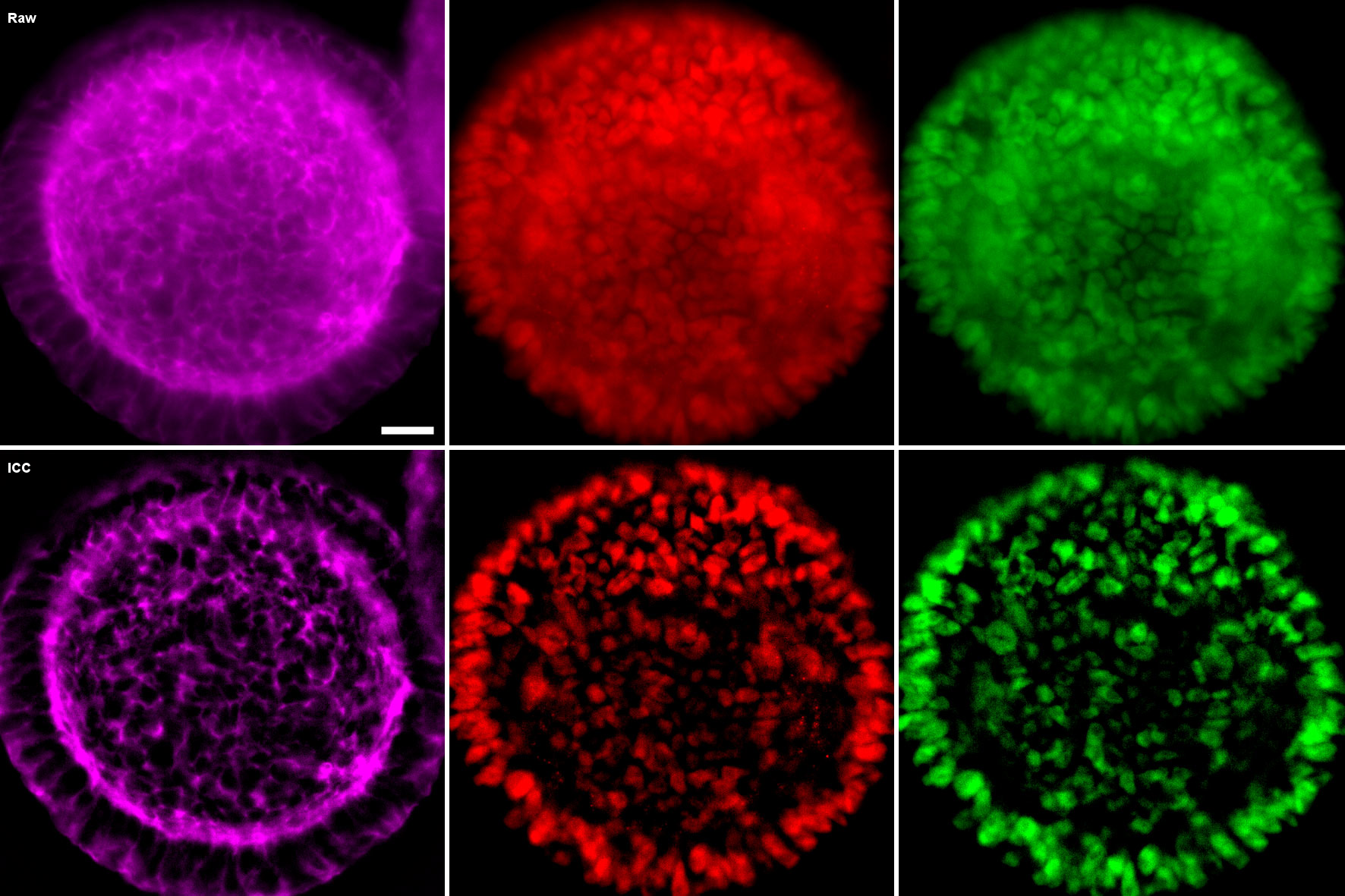 Human induced pluripotent stem cells in 3D cyst conformation