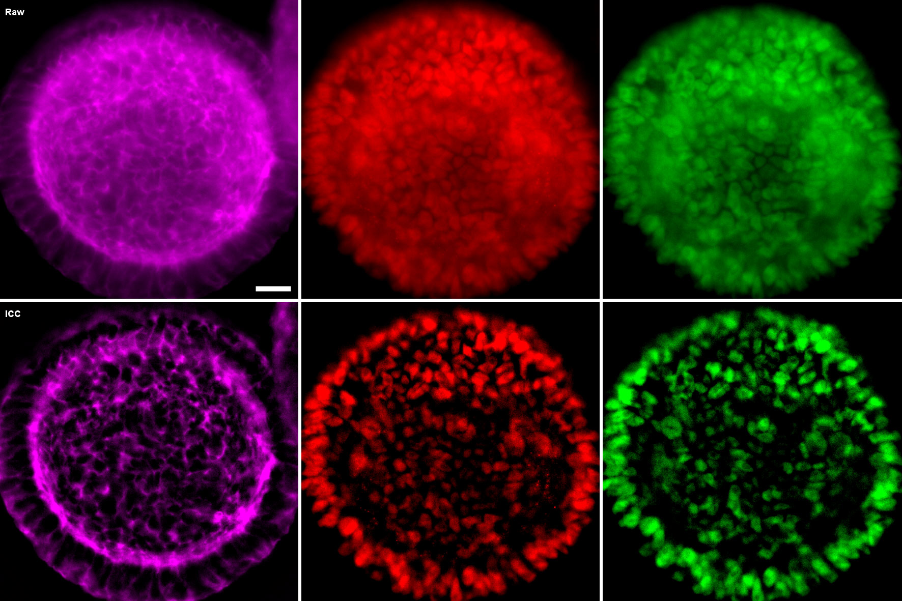 Human induced pluripotent stem cells in 3D cyst conformation Human induced pluripotent stem cells in 3D cyst conformation