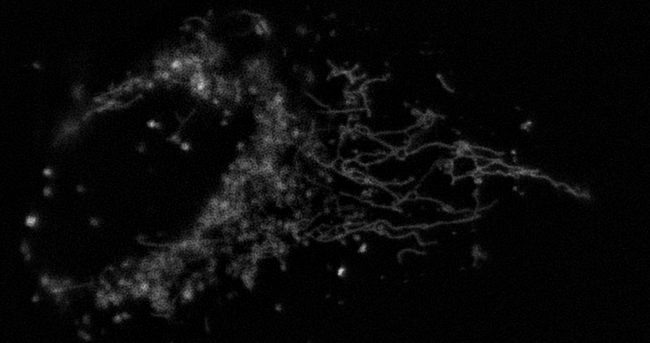 U2OS cell, human osteosarcoma Mitochondria - low light exposure