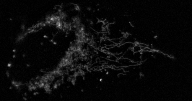 THUNDER - low light exposure U2OS cell, human osteosarcoma Mitochondria - low light exposure
